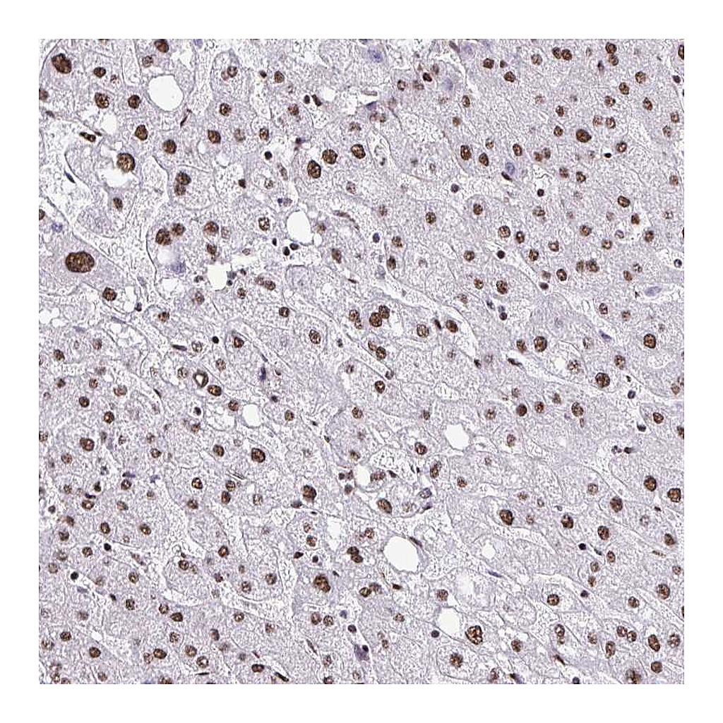 Atlas Antibodies Anti-NRBF2 Antibody