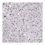 Atlas Antibodies Anti-NRBF2 Antibody