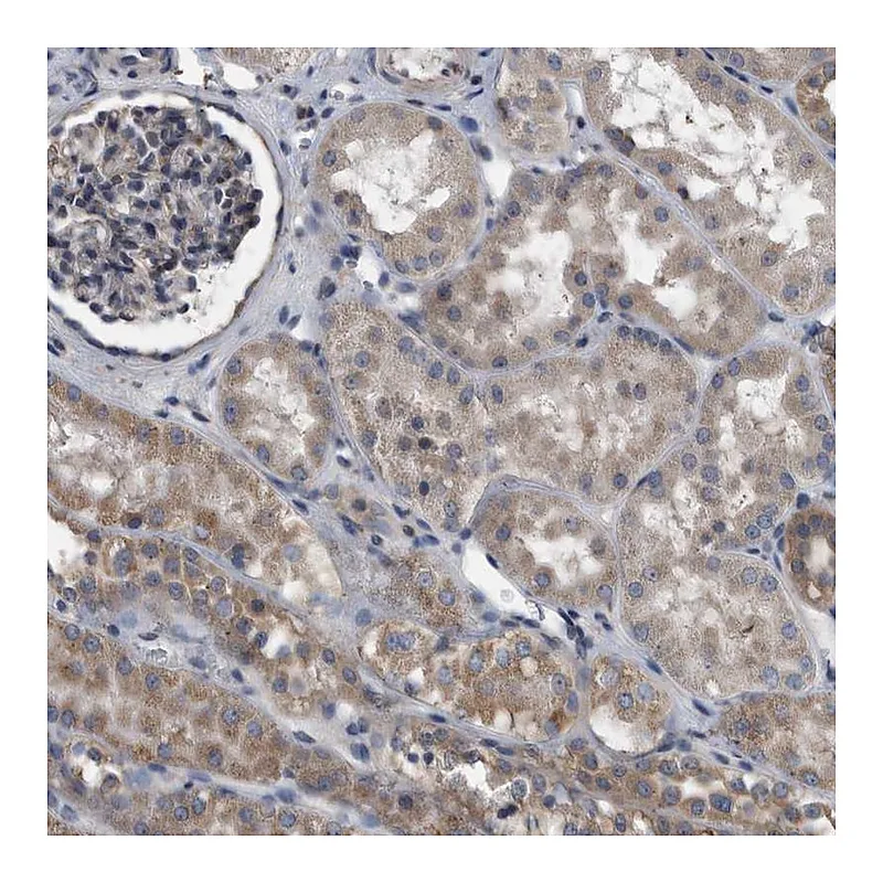 Atlas Antibodies Anti-NRBP1 Antibody