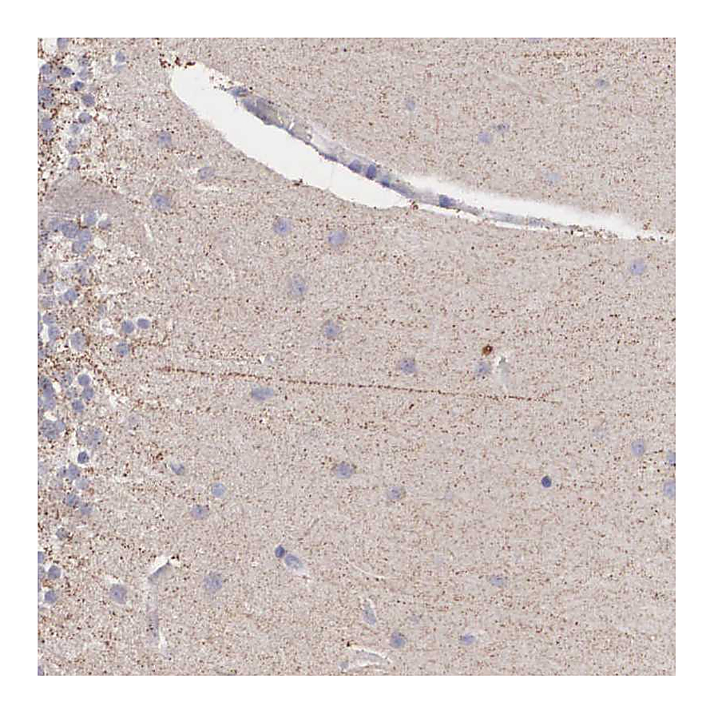 Atlas Antibodies Anti-NREP Antibody
