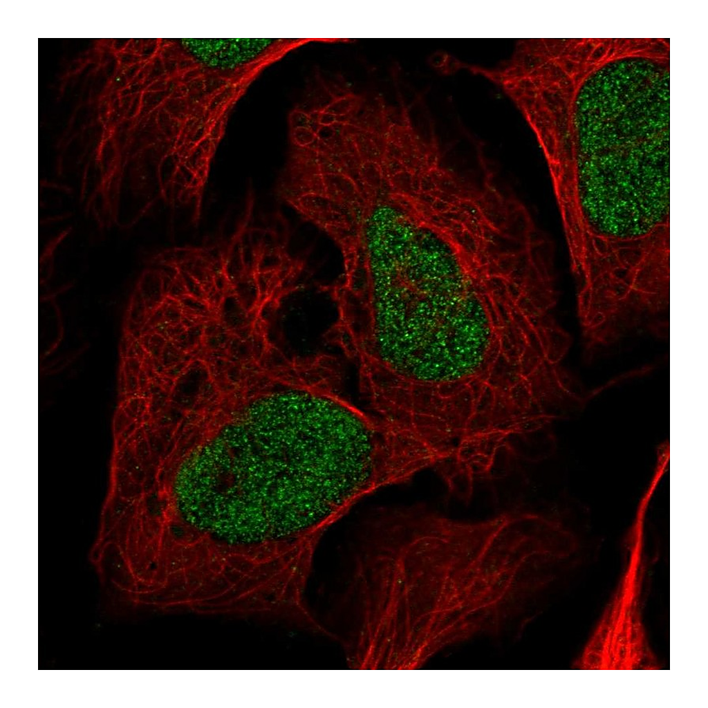 Atlas Antibodies Anti-NRDC Antibody