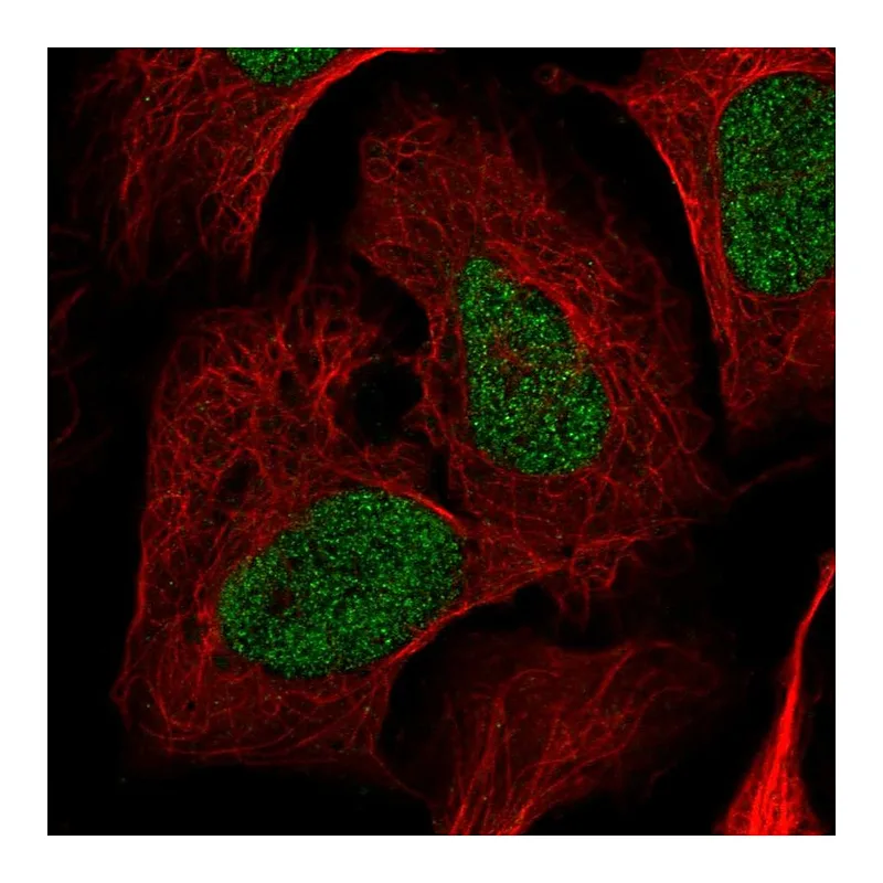 Atlas Antibodies Anti-NRDC Antibody