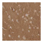Atlas Antibodies Anti-NRCAM Antibody