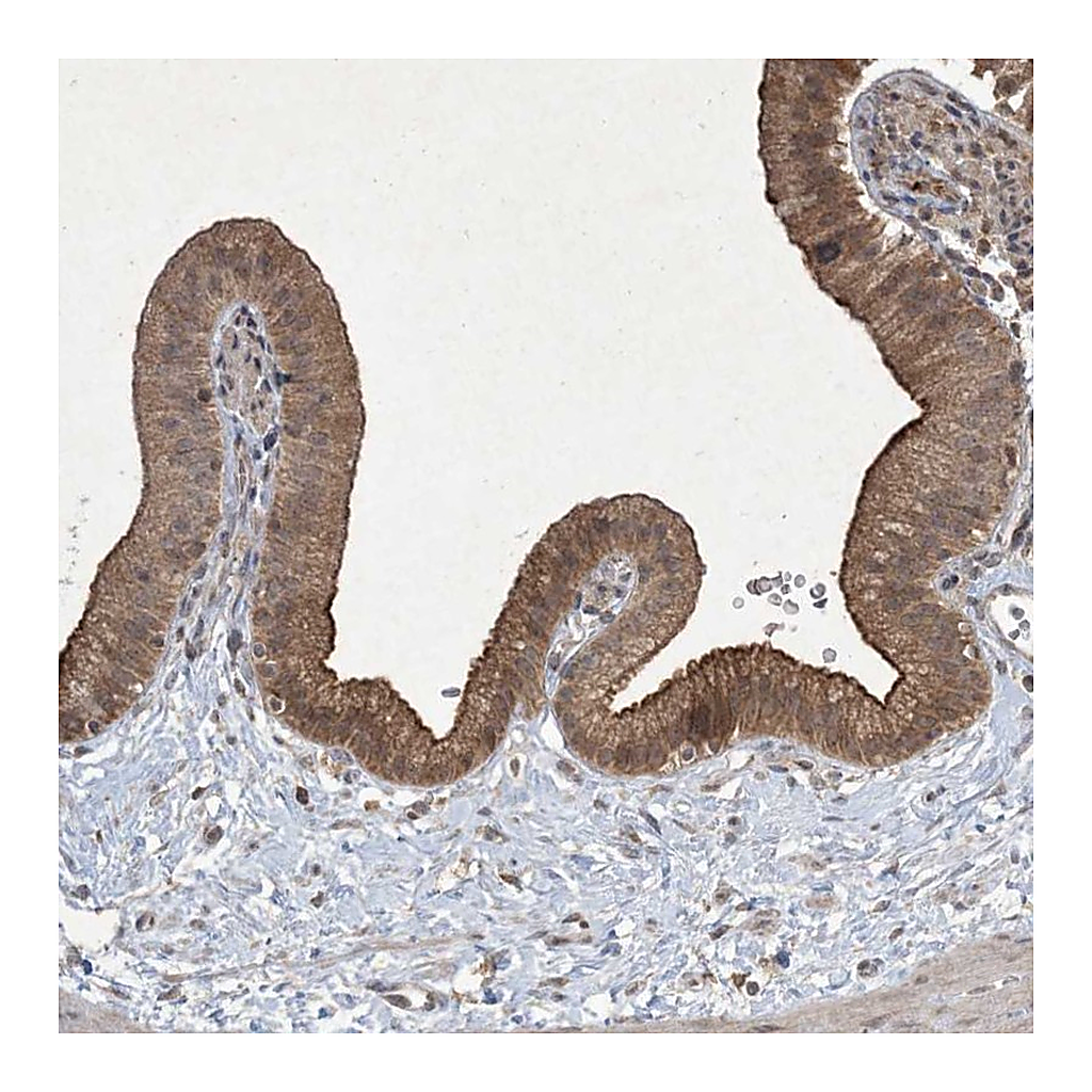 Atlas Antibodies Anti-NRBP2 Antibody
