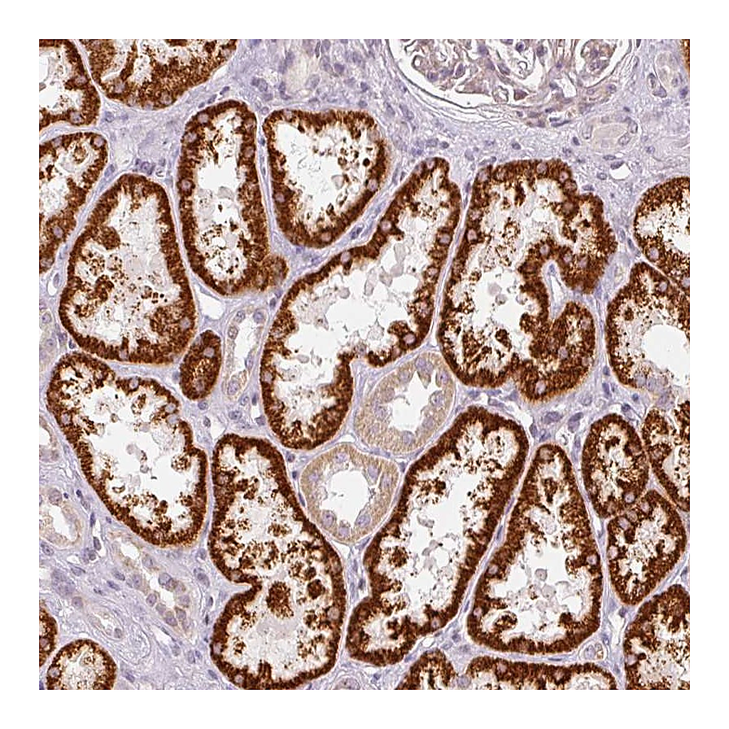 Atlas Antibodies Anti-NRDE2 Antibody