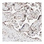 Atlas Antibodies Anti-NRF1 Antibody
