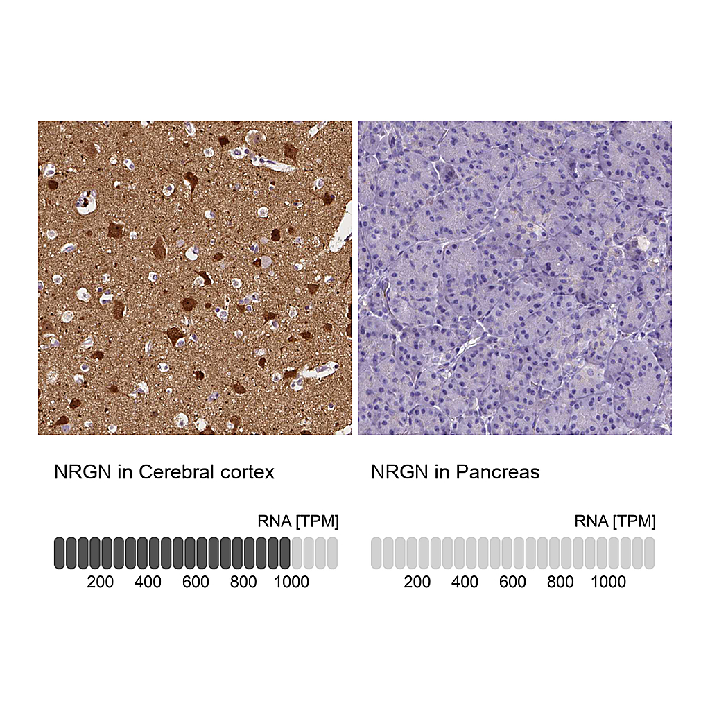 Atlas Antibodies Anti-NRGN Antibody