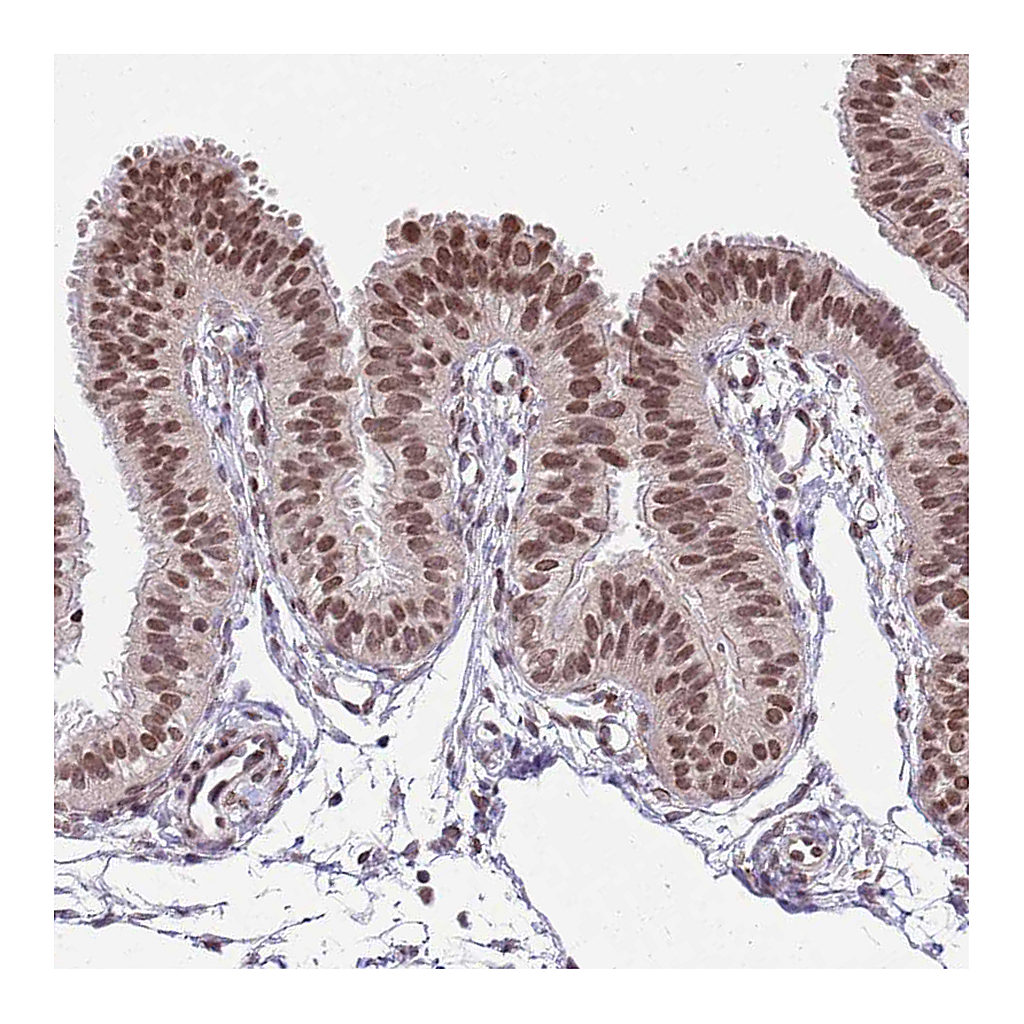 Atlas Antibodies Anti-NRIP1 Antibody