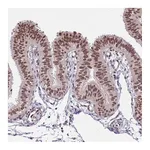 Atlas Antibodies Anti-NRIP1 Antibody