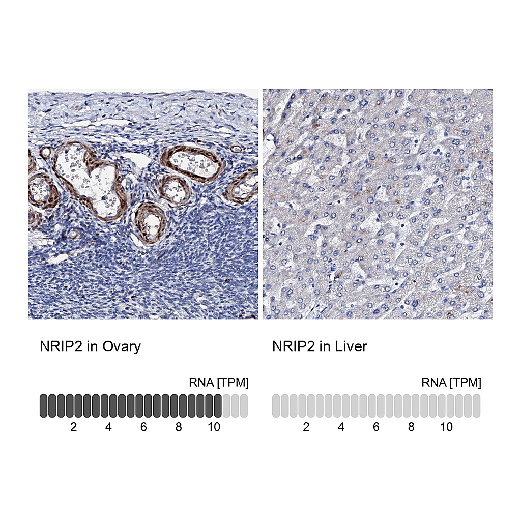 Atlas Antibodies Anti-NRIP2 Antibody