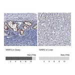 Atlas Antibodies Anti-NRIP2 Antibody