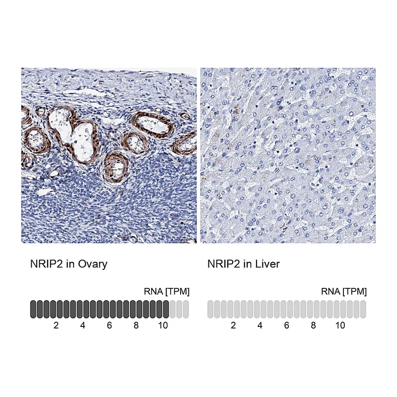 Atlas Antibodies Anti-NRIP2 Antibody