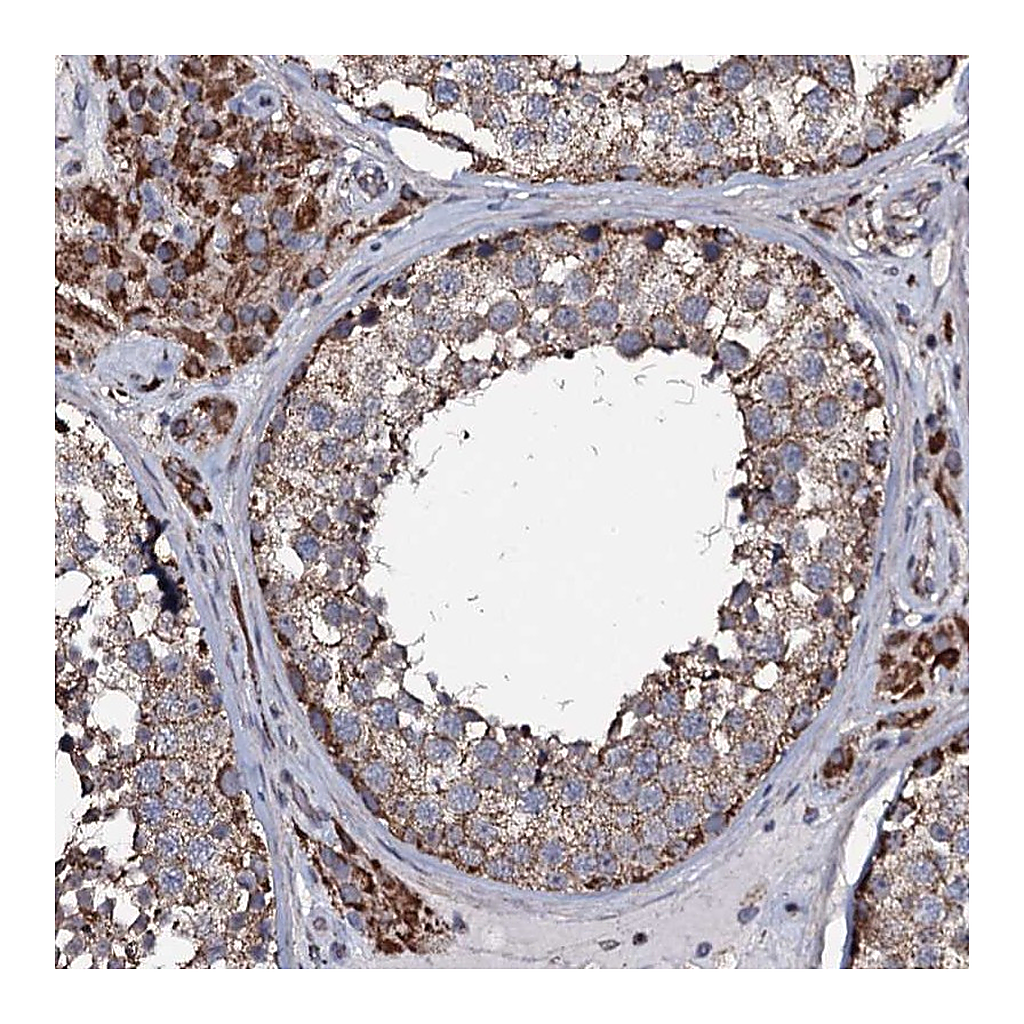 Atlas Antibodies Anti-NRIP3 Antibody