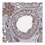 Atlas Antibodies Anti-NRIP3 Antibody