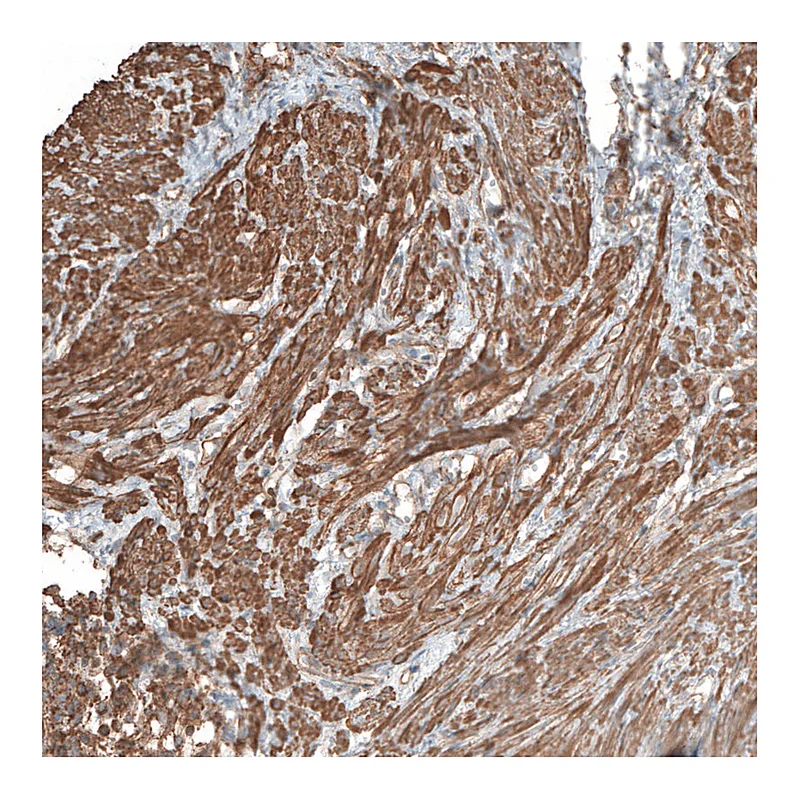 Atlas Antibodies Anti-NRP2 Antibody