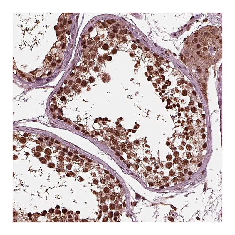 Atlas Antibodies Anti-NSD1 Antibody