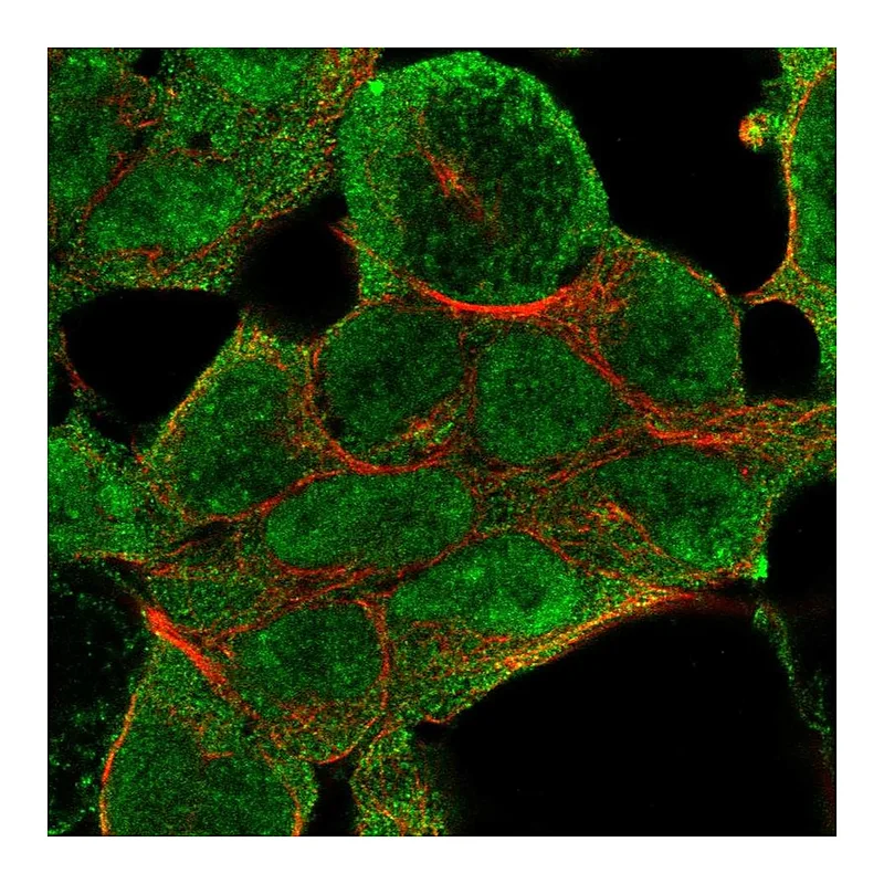 Atlas Antibodies Anti-NSD1 Antibody