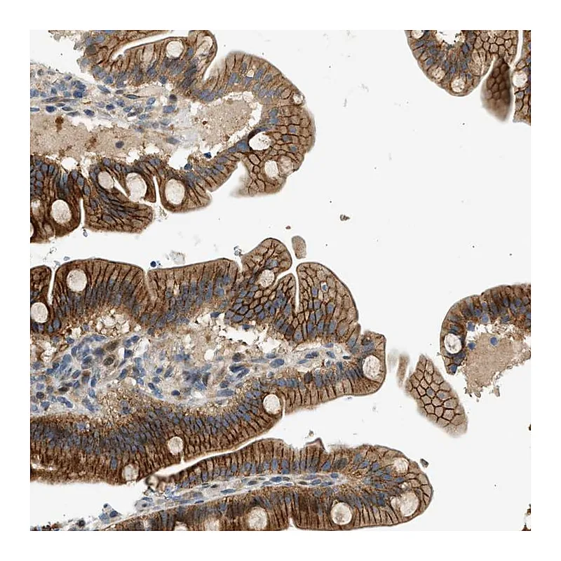 Atlas Antibodies Anti-NRSN2 Antibody