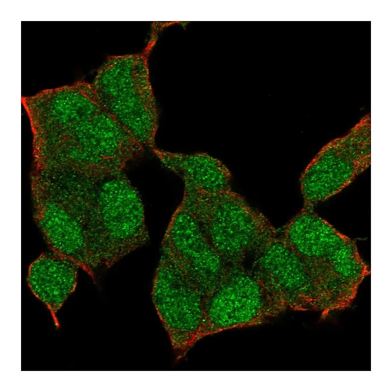 Atlas Antibodies Anti-NSD1 Antibody