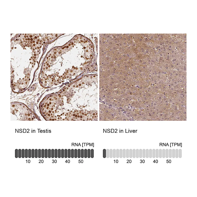 Atlas Antibodies Anti-NSD2 Antibody