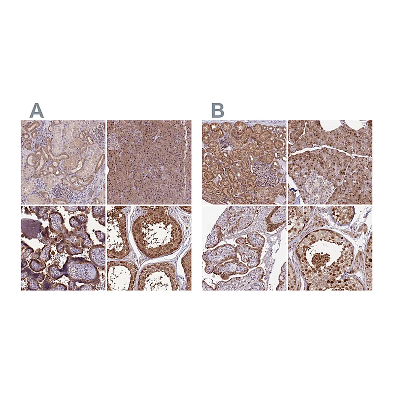 Atlas Antibodies Anti-NSFL1C Antibody