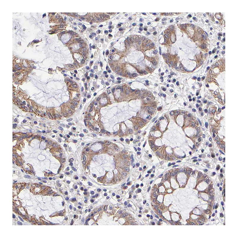 Atlas Antibodies Anti-NSF Antibody