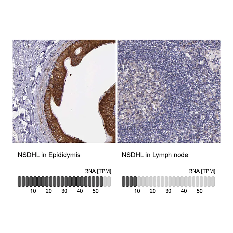 Atlas Antibodies Anti-NSDHL Antibody
