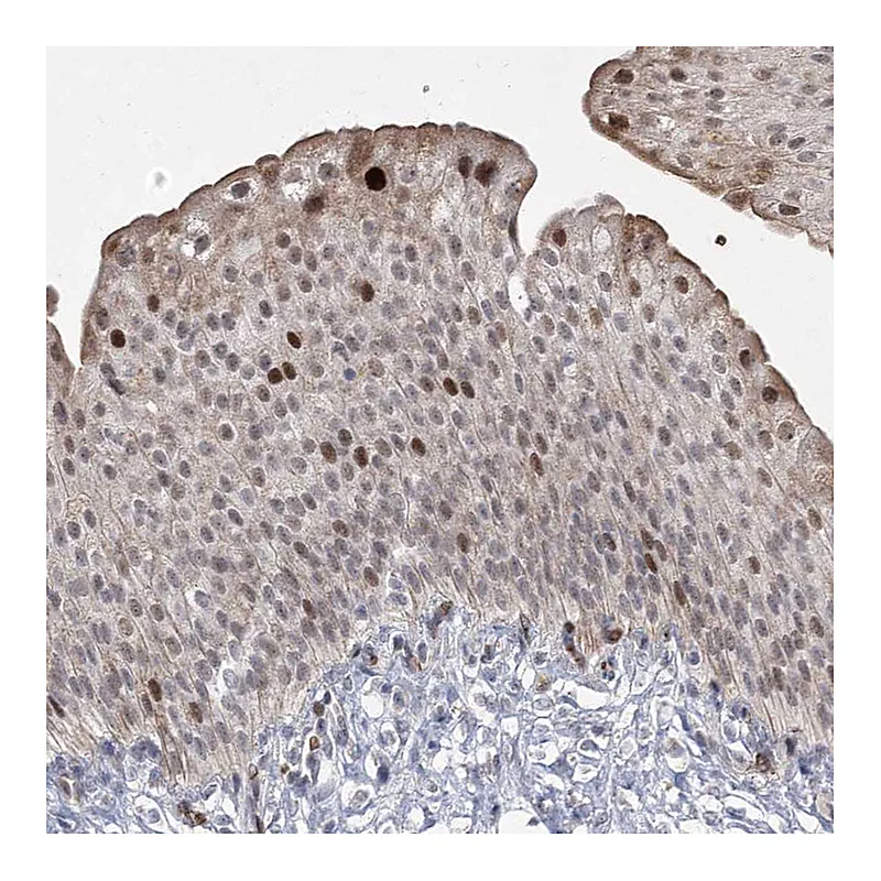 Atlas Antibodies Anti-NSMCE4A Antibody