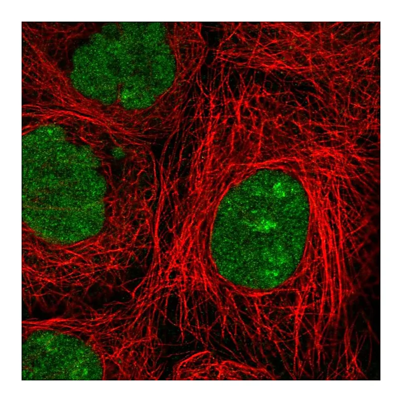 Atlas Antibodies Anti-NSMCE2 Antibody