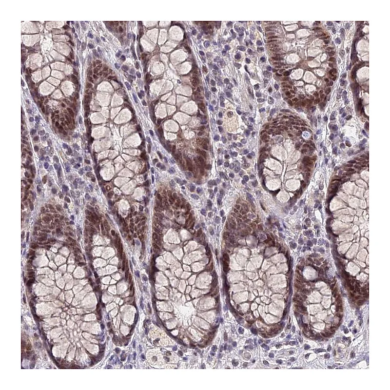 Atlas Antibodies Anti-NSMCE1 Antibody