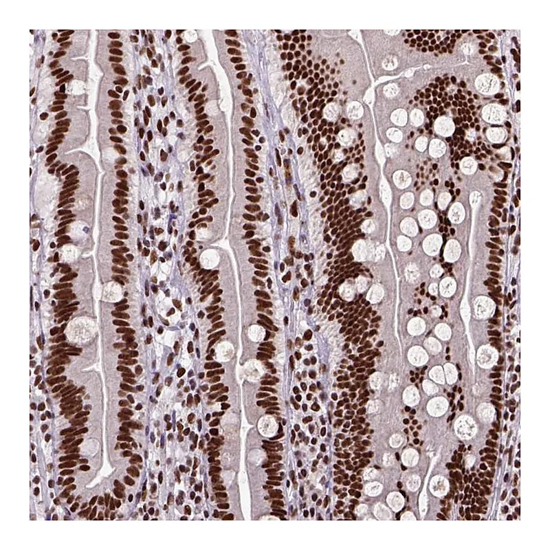 Atlas Antibodies Anti-NSMCE2 Antibody
