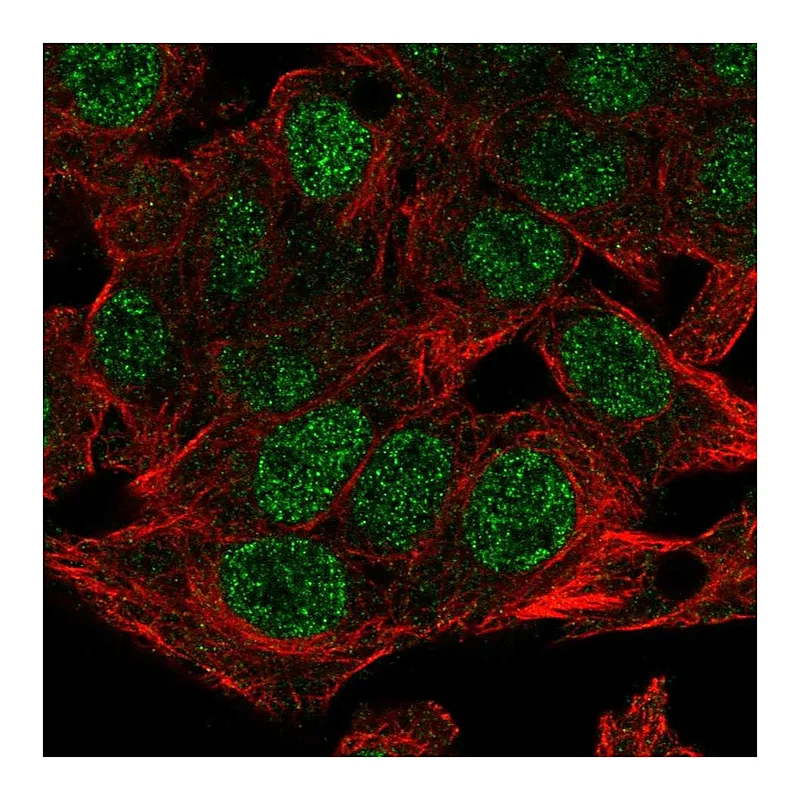 Atlas Antibodies Anti-NSMCE4A Antibody
