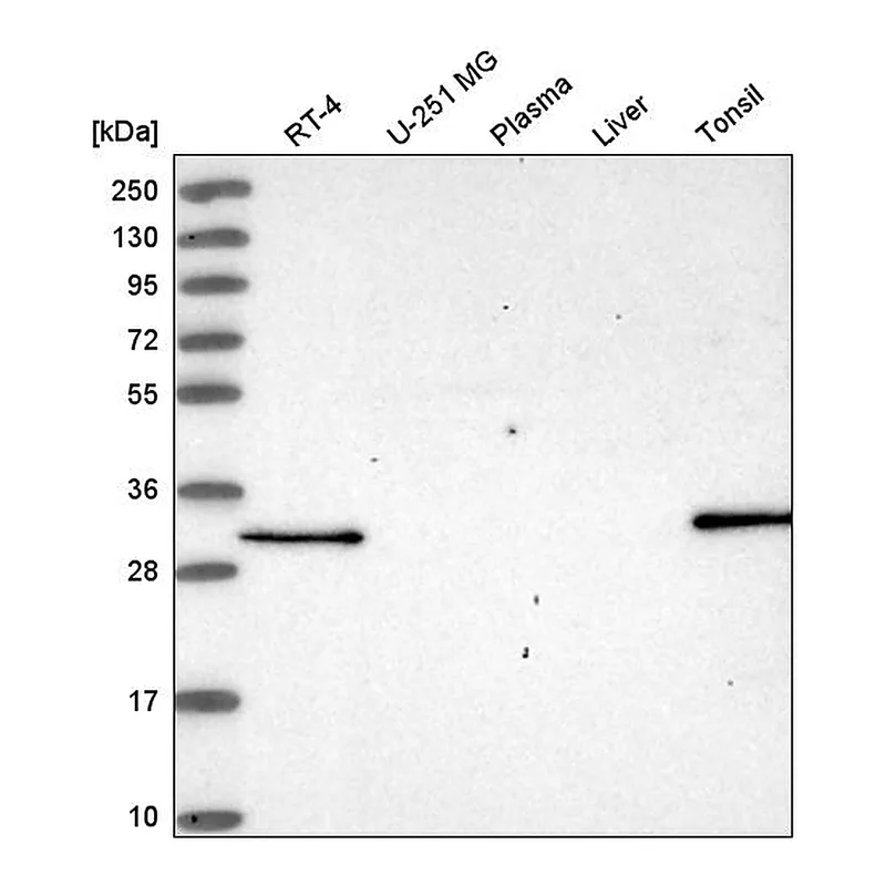 Atlas Antibodies Anti-NSMCE4A Antibody