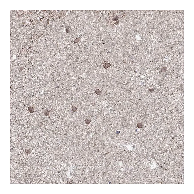 Atlas Antibodies Anti-NSMF Antibody
