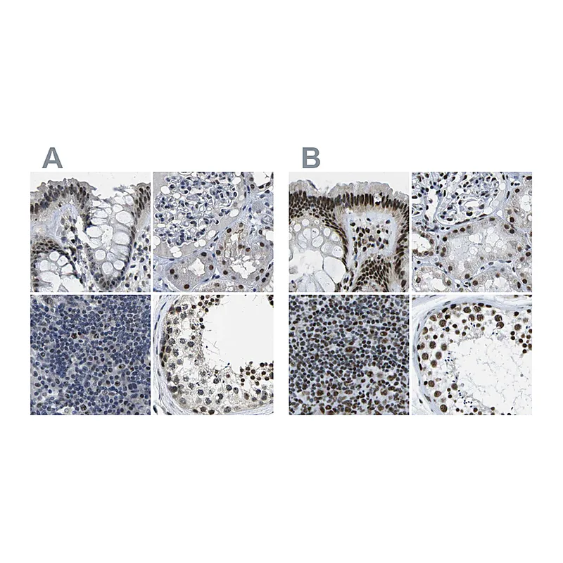 Atlas Antibodies Anti-NSRP1 Antibody