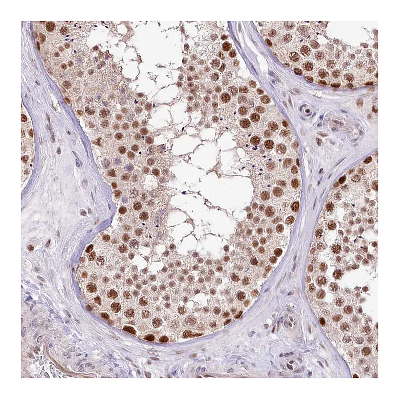 Atlas Antibodies Anti-NSUN2 Antibody