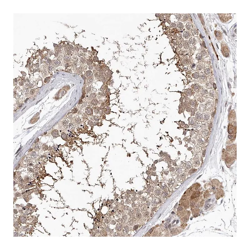 Atlas Antibodies Anti-NSUN4 Antibody