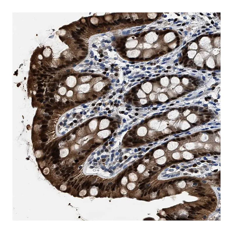 Atlas Antibodies Anti-NSUN5 Antibody