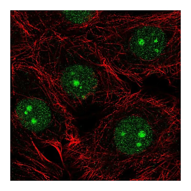 Atlas Antibodies Anti-NSUN5 Antibody