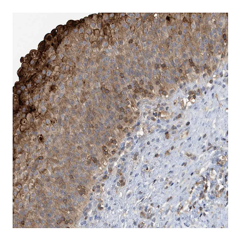 Atlas Antibodies Anti-NSUN3 Antibody