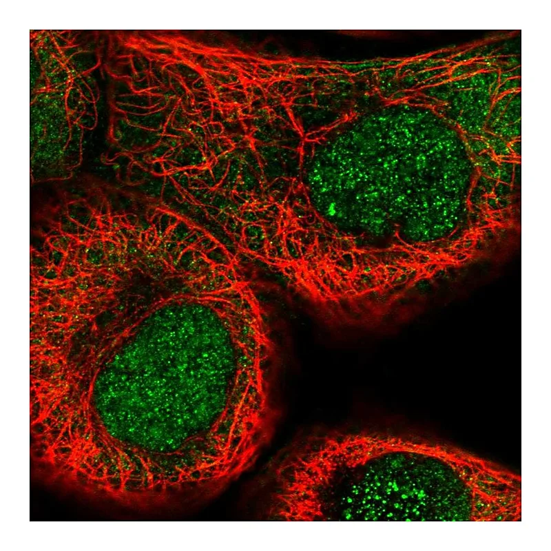 Atlas Antibodies Anti-NSUN5 Antibody