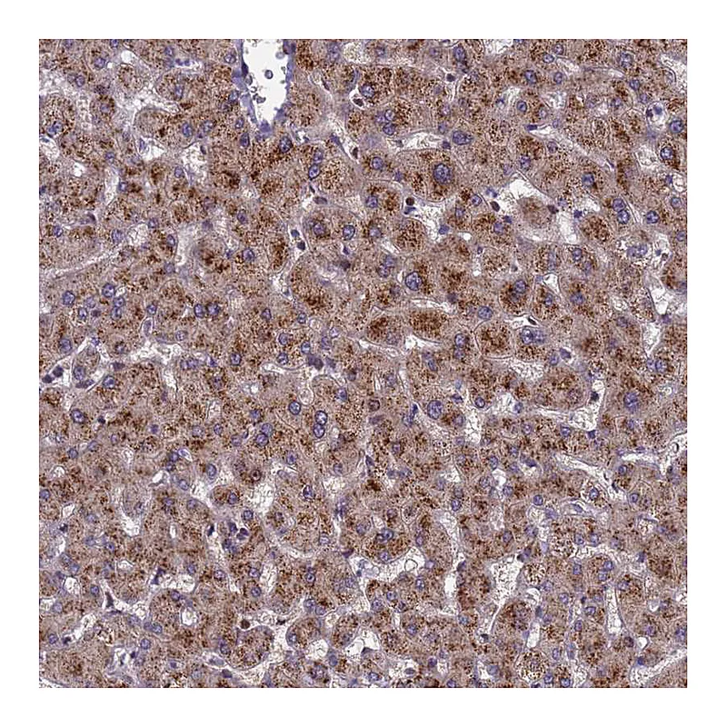 Atlas Antibodies Anti-NSUN6 Antibody