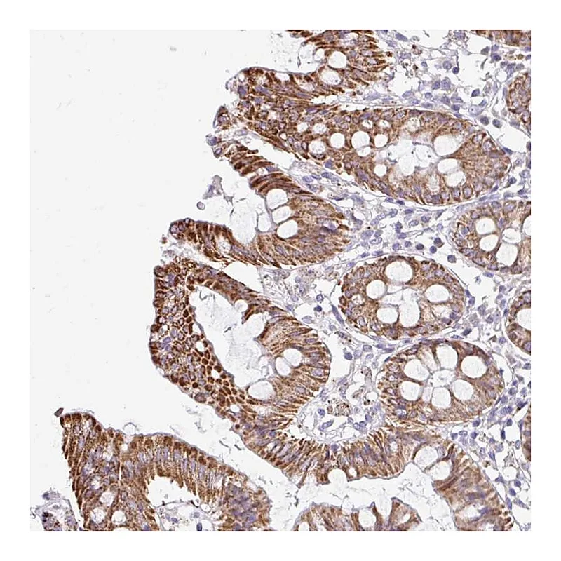 Atlas Antibodies Anti-NT5C1B Antibody