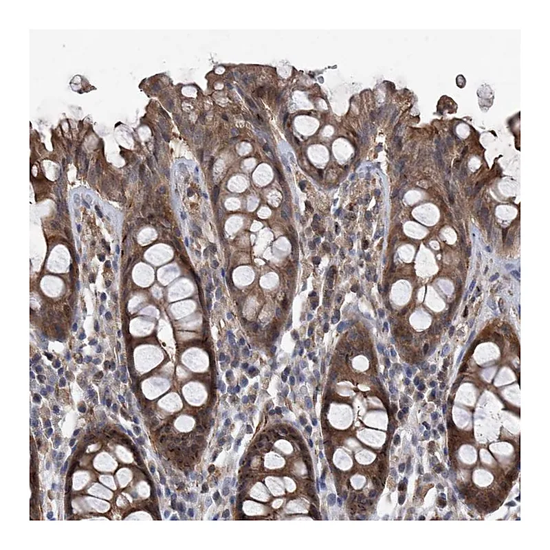 Atlas Antibodies Anti-NT5C3A Antibody
