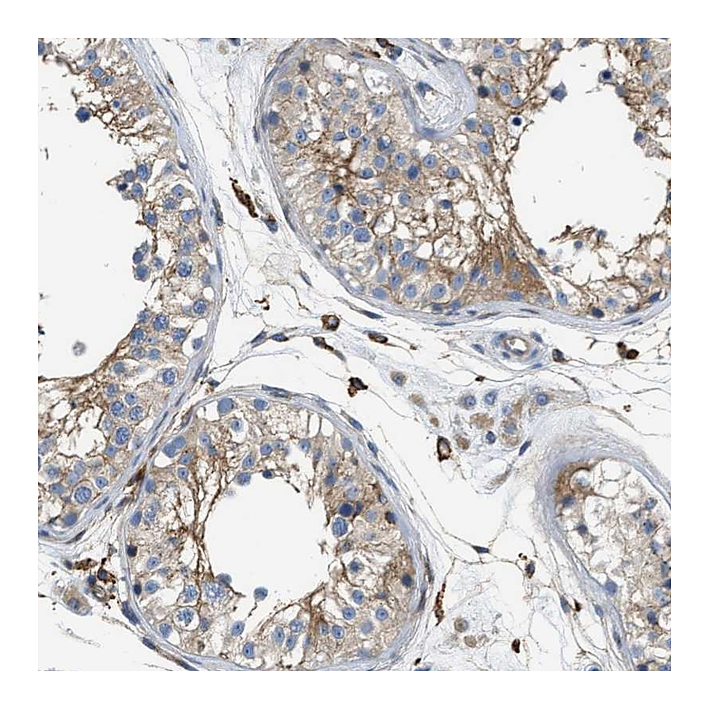 Atlas Antibodies Anti-NSUN7 Antibody