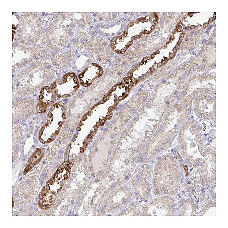 Atlas Antibodies Anti-NT5C1A Antibody