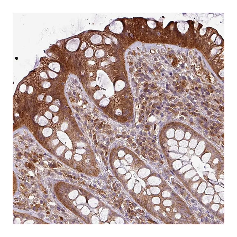 Atlas Antibodies Anti-NT5C3A Antibody