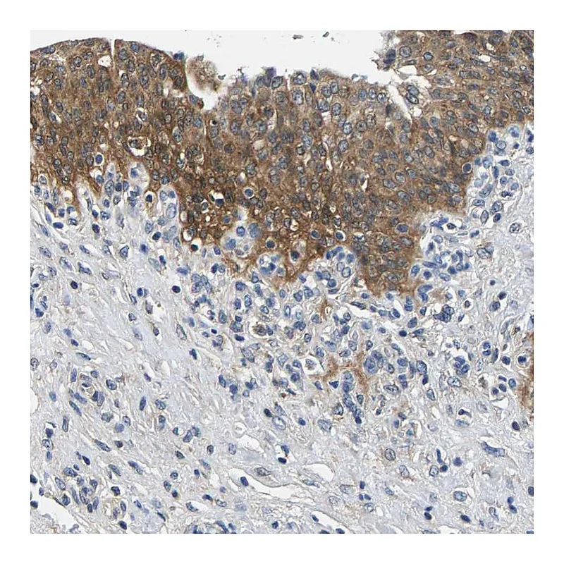 Atlas Antibodies Anti-NT5C Antibody