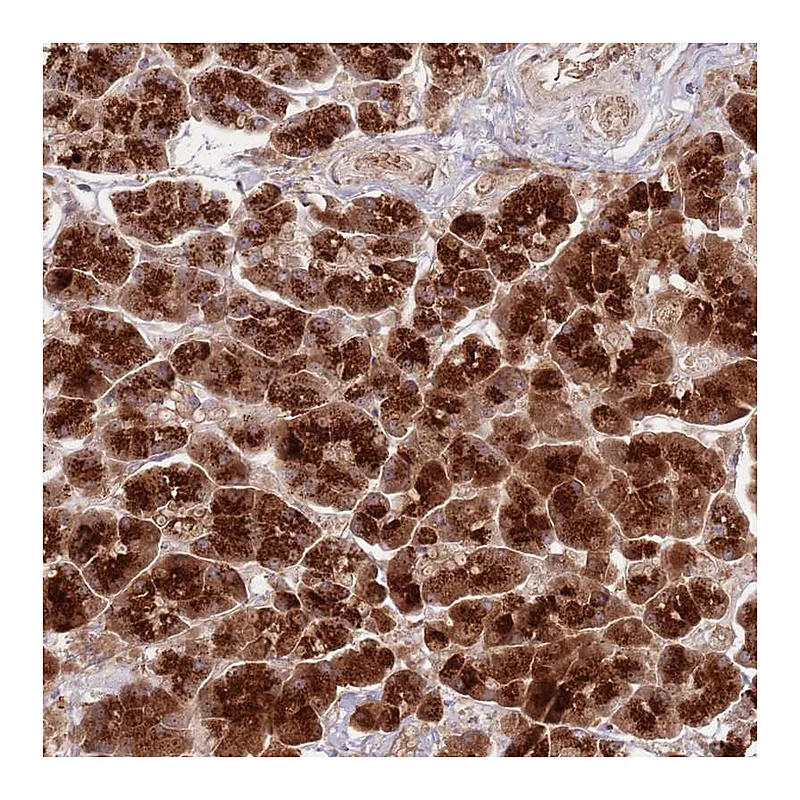 Atlas Antibodies Anti-NT5DC4 Antibody