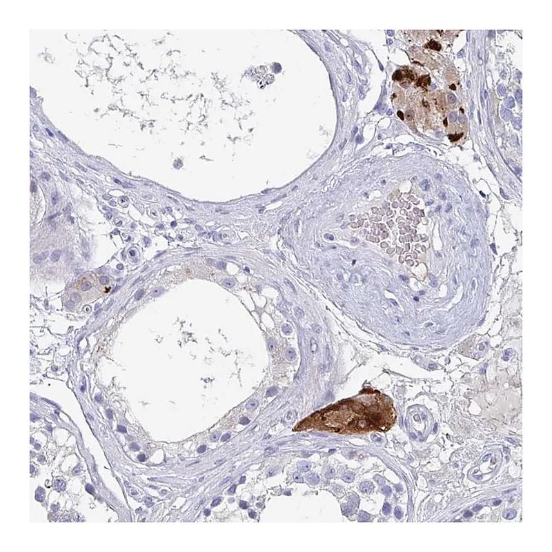Atlas Antibodies Anti-NT5C3B Antibody